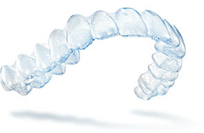 Invisalign has helped adults all over the La Mesa area.