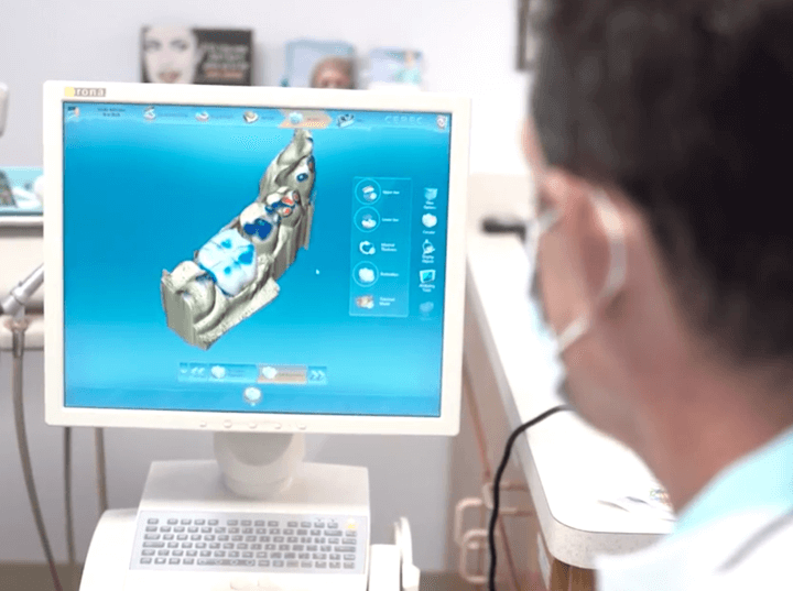 cerec crowns from cosmetic dentist, dr. hagstrom - la mesa